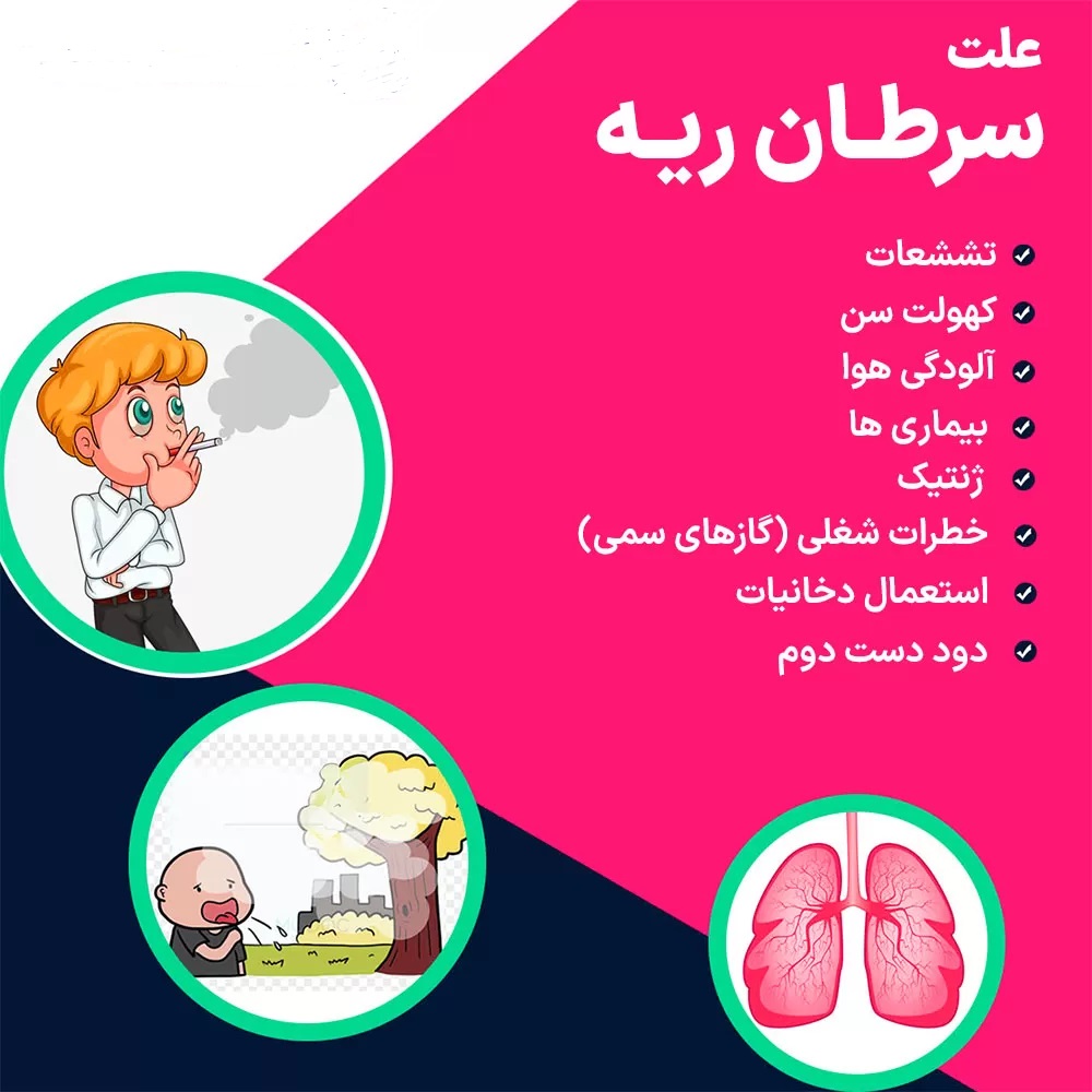 سرطان ریه