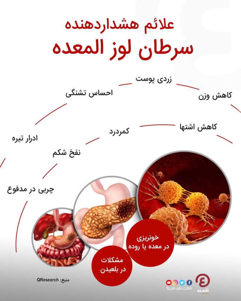 سرطان لوزالمعده