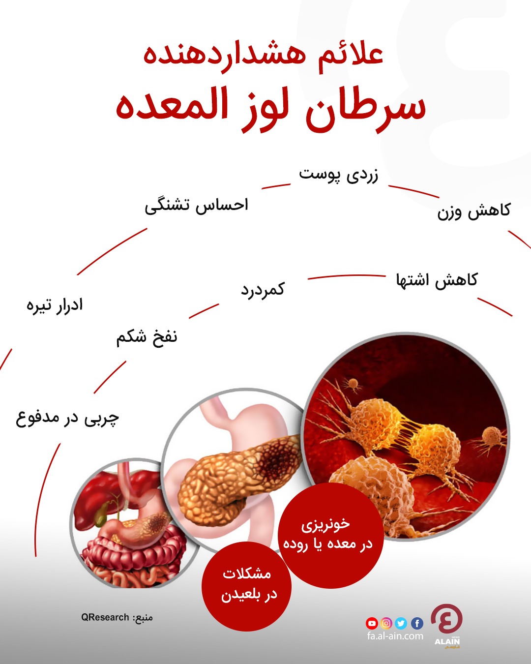 سرطان لوزالمعده