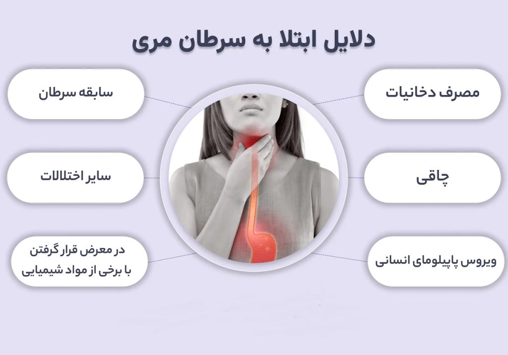 سرطان مری